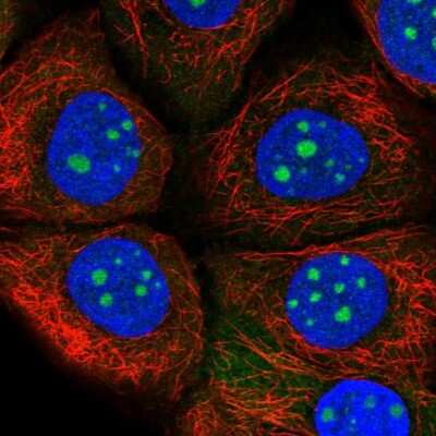 Immunocytochemistry/ Immunofluorescence: TrpC2-like protein Antibody [NBP2-14726]