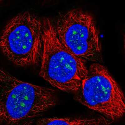 Immunocytochemistry/ Immunofluorescence: TrpC2-like protein Antibody [NBP2-58169]