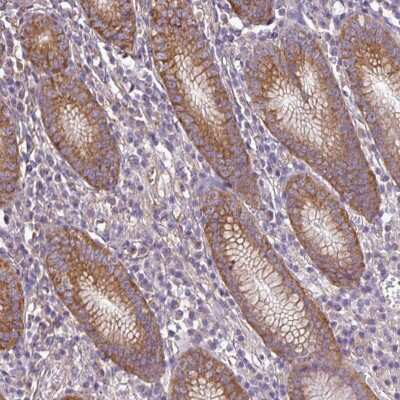 Immunohistochemistry-Paraffin: TrpC2-like protein Antibody [NBP2-14726]