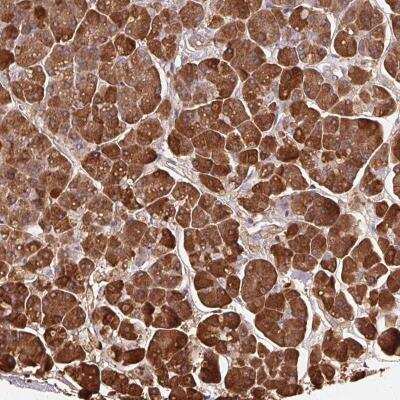 Immunohistochemistry-Paraffin: Trypsin 1/PRSS1 Antibody [NBP2-46871]