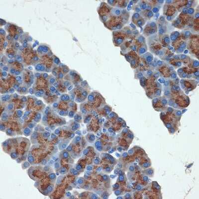 Immunohistochemistry-Paraffin: Trypsin 2/PRSS2 Antibody (3D9O7) [NBP3-15733]