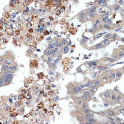 Immunohistochemistry-Paraffin: Trypsin 2/PRSS2 Antibody (3D9O7) [NBP3-15733]