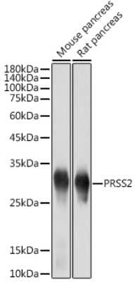 Western Blot: Trypsin 2/PRSS2 Antibody (3D9O7) [NBP3-15733]