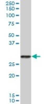 Western Blot: Trypsin 2/PRSS2 Antibody [H00005645-B01P]