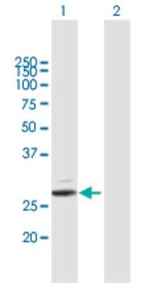 Western Blot: Trypsin 2/PRSS2 Antibody [H00005645-B01P]