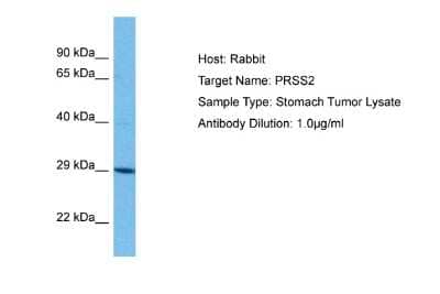 Western Blot: Trypsin 2/PRSS2 Antibody [NBP2-86879]