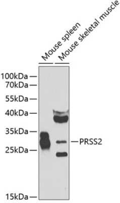 Western Blot: Trypsin 2/PRSS2 AntibodyBSA Free [NBP2-93609]