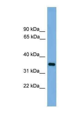 Western Blot: Trypsin 3/PRSS3 Antibody [NBP1-57036]