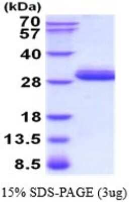 SDS-PAGE: Recombinant Human Trypsin 3/PRSS3 His Protein [NBP2-52220]