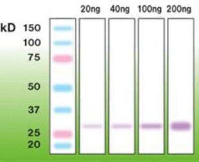 Western Blot: Trypsin 1/PRSS1 Antibody (A16-N) [NBP1-30135]