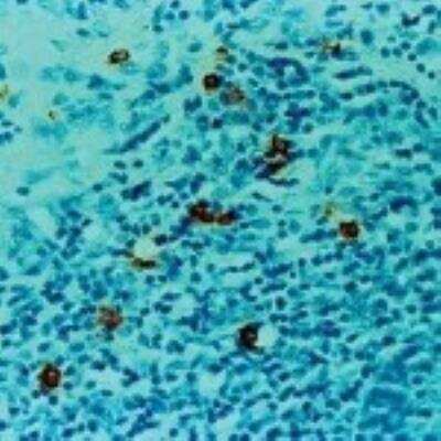 Immunohistochemistry-Paraffin: Tryptase alpha/beta 1 Antibody (AA1) [NBP2-26444]