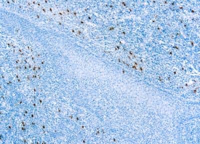 Immunohistochemistry-Paraffin: Tryptase alpha/beta 1 Antibody (AA1) [NBP2-26444]