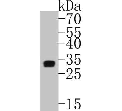 Western Blot: Tryptase alpha/beta 1 Antibody (SC68-07) [NBP2-67608]