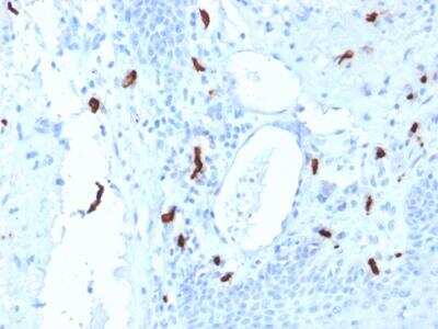 Immunohistochemistry-Paraffin: Tryptase alpha/beta 1 Antibody (TPSAB1/1961) - Azide and BSA Free [NBP2-75754]