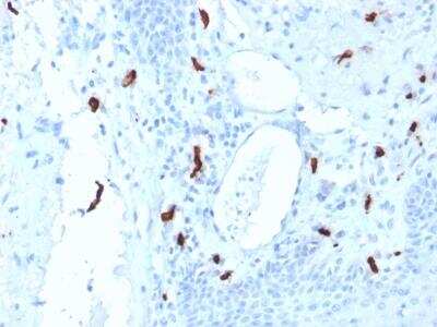 Immunohistochemistry-Paraffin: Tryptase alpha/beta 1 Antibody (TPSAB1/1961) [NBP2-75751]