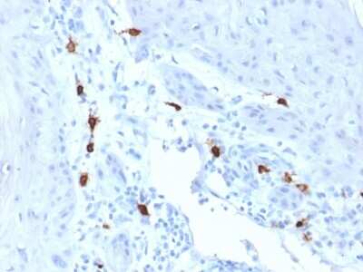 Immunohistochemistry-Paraffin: Tryptase alpha/beta 1 Antibody (TPSAB1/1963) - Azide and BSA Free [NBP3-08649]