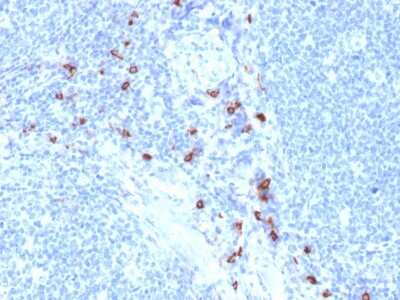 Immunohistochemistry-Paraffin: Tryptase alpha/beta 1 Antibody (TPSAB1/1963) - Azide and BSA Free [NBP3-08649]