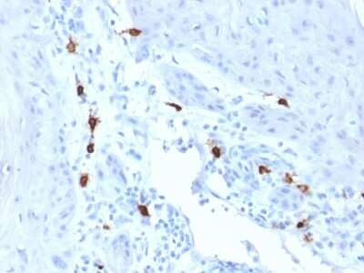 Immunohistochemistry-Paraffin: Tryptase alpha/beta 1 Antibody (TPSAB1/1963) [NBP3-07698]