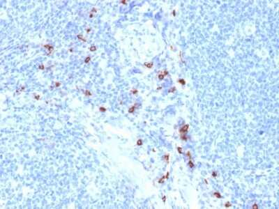 Immunohistochemistry-Paraffin: Tryptase alpha/beta 1 Antibody (TPSAB1/1963) [NBP3-07698]