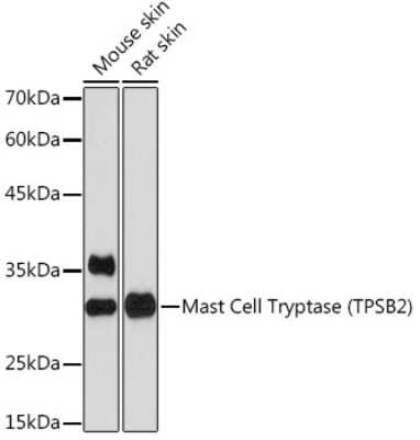 Western Blot: Tryptase beta-2/TPSB2 Antibody (6U1C5) [NBP3-15925]