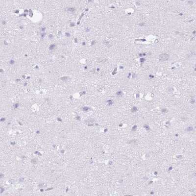 Immunohistochemistry-Paraffin: Tryptase beta-2/TPSB2 Antibody [NBP2-33551]