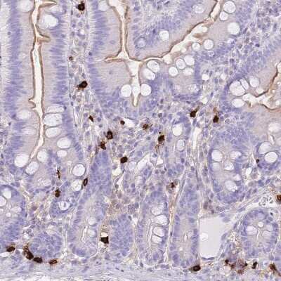 Immunohistochemistry-Paraffin: Tryptase beta-2/TPSB2 Antibody [NBP2-33551]