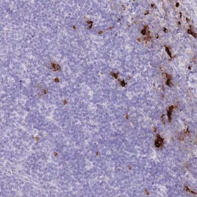 Immunohistochemistry-Paraffin: Tryptase beta-2/TPSB2 Antibody [NBP2-33551]