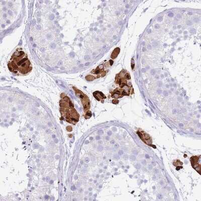 Immunohistochemistry-Paraffin: Tryptase beta-2/TPSB2 Antibody [NBP2-33551]
