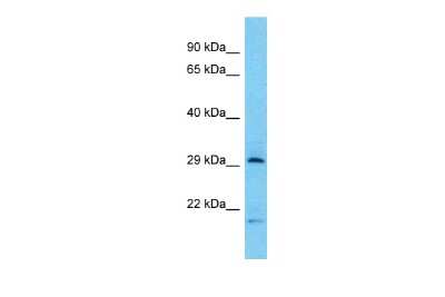 Western Blot: Tryptase beta-2/TPSB2 Antibody [NBP2-88496]