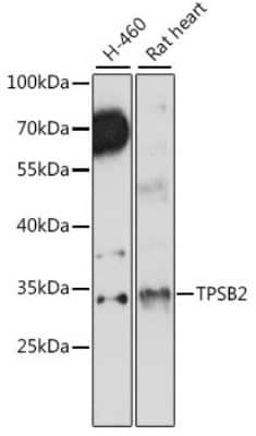 Western Blot: Tryptase beta-2/TPSB2 AntibodyAzide and BSA Free [NBP3-05583]
