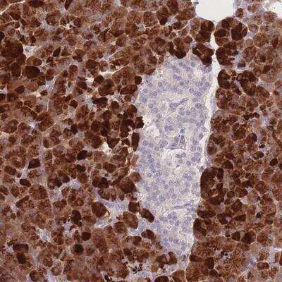 Immunohistochemistry-Paraffin: Tryptase epsilon/BSSP-4/PRSS22 Antibody [NBP2-13817]