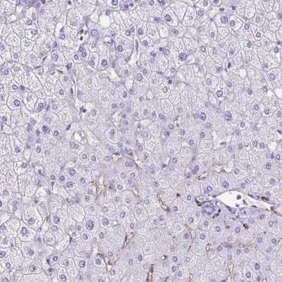 Immunohistochemistry-Paraffin: Tryptase gamma-1/TPSG1 Antibody [NBP2-37977]