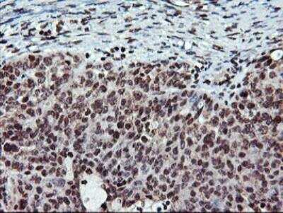 Immunohistochemistry-Paraffin: Tryptase gamma-1/TPSG1 Antibody (OTI1G1) - Azide and BSA Free [NBP2-74652]