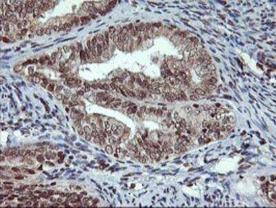 Immunohistochemistry-Paraffin: Tryptase gamma-1/TPSG1 Antibody (OTI1G1) - Azide and BSA Free [NBP2-74652]