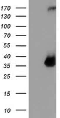 Western Blot: Tryptase gamma-1/TPSG1 Antibody (OTI1G1) [NBP2-01679]