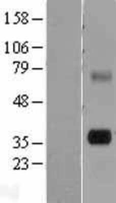 Western Blot: Tryptase gamma-1/TPSG1 Overexpression Lysate [NBL1-17231]