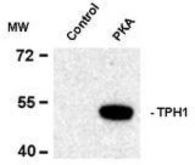 Western Blot: Tryptophan Hydroxylase 1/TPH-1 [p Ser58] Antibody [NB300-260]