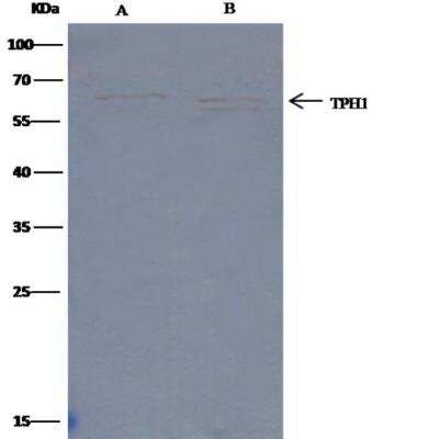 Immunoprecipitation: Tryptophan Hydroxylase 1/TPH-1 Antibody (145) [NBP2-90022]