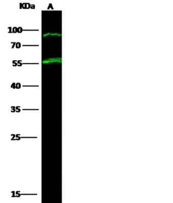 Western Blot: Tryptophan Hydroxylase 1/TPH-1 Antibody (145) [NBP2-90022]