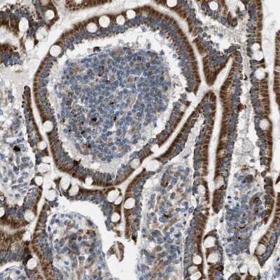 Immunohistochemistry-Paraffin: Tryptophan Hydroxylase 1/TPH-1 Antibody [NBP1-86922]