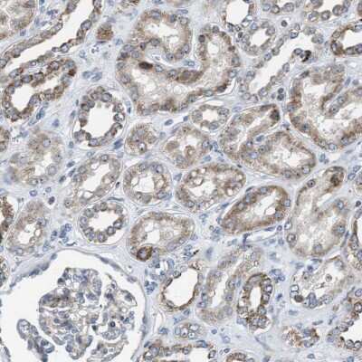 Immunohistochemistry-Paraffin: Tryptophan Hydroxylase 1/TPH-1 Antibody [NBP1-86922]
