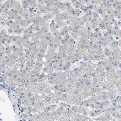 Immunohistochemistry-Paraffin: Tryptophan Hydroxylase 1/TPH-1 Antibody [NBP1-86922]