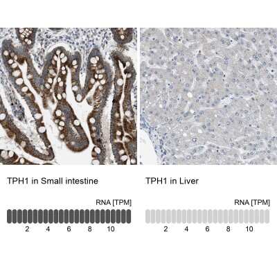 Immunohistochemistry-Paraffin: Tryptophan Hydroxylase 1/TPH-1 Antibody [NBP1-86922]