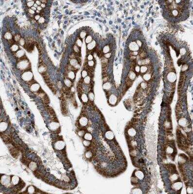 Immunohistochemistry-Paraffin: Tryptophan Hydroxylase 1/TPH-1 Antibody [NBP1-86922]