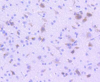 Immunohistochemistry-Paraffin: Tryptophan Hydroxylase 1/TPH-1 Antibody (SC53-07) [NBP2-67580]