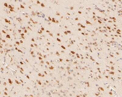 Immunohistochemistry-Paraffin: Tryptophan Hydroxylase 1/TPH-1 Antibody (SC53-07) [NBP2-67580]
