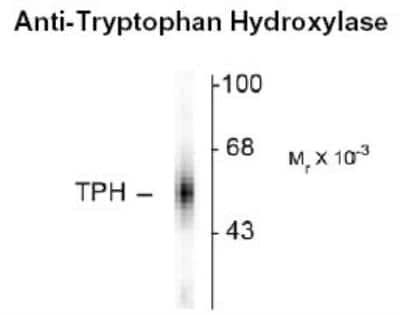 Western Blot: Tryptophan Hydroxylase 1/TPH-1 Antibody [NB300-176]