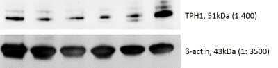Western Blot: Tryptophan Hydroxylase 1/TPH-1 Antibody [NBP1-86922]