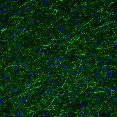 Immunohistochemistry: Tryptophan hydroxylase 2 Antibody (CL2990) [NBP2-46646]