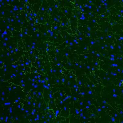 Immunohistochemistry: Tryptophan hydroxylase 2 Antibody (CL2990) [NBP2-46646]